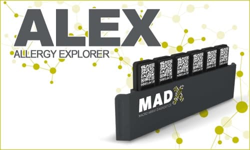 Test ALEX - łatwe rozpoznanie alergii w nanotechnologii