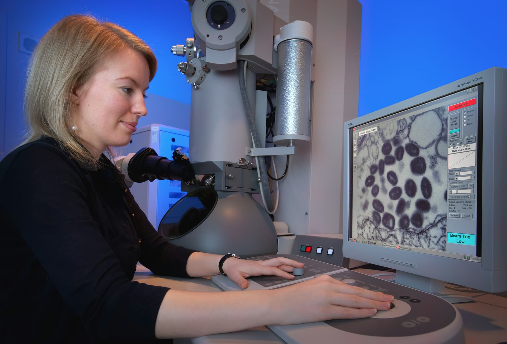 Czarna ospa (ospa prawdziwa): objawy, diagnostyka i co zrobić przy podejrzeniu